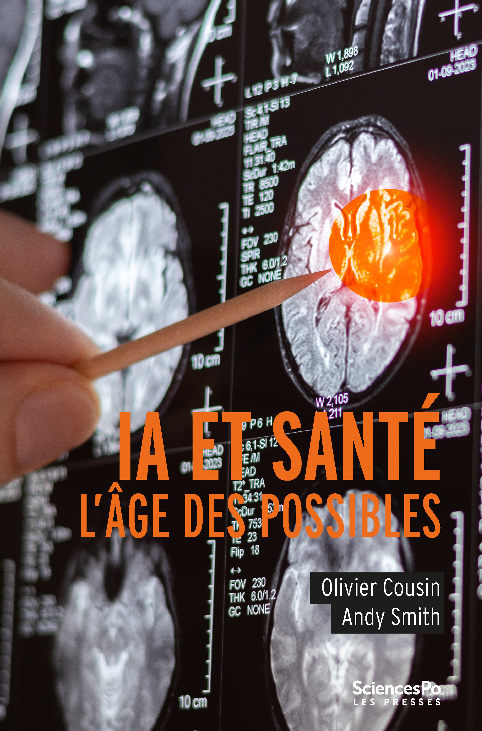IA et Santé