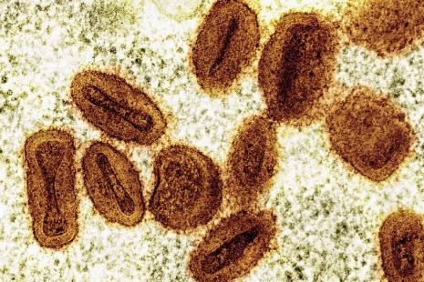 Image microscope du virus de la variole B