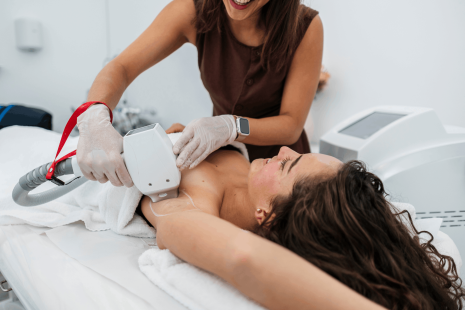 laser, épilation, esthétique