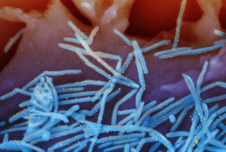 Micrographie Electronique à Balayage (MEB) du virus respiratoire syncytial humain (RSV) paramyovirus responsable de bronchite et pneumonie infantile marqué avec des anticorps anti-RSV
