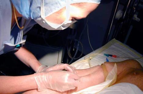 perfusion bras patient