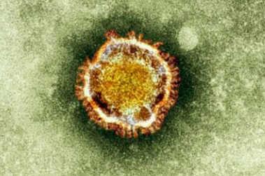 coronavirus