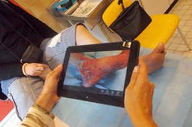 Domoplaie une tablette connectée à la plate-forme de télémédecine