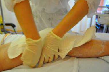 Plaies et cicatrisation : quoi de neuf en 2013 ?