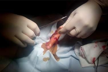 Suture de plaie simple aux urgences : l’infirmier désormais habilité