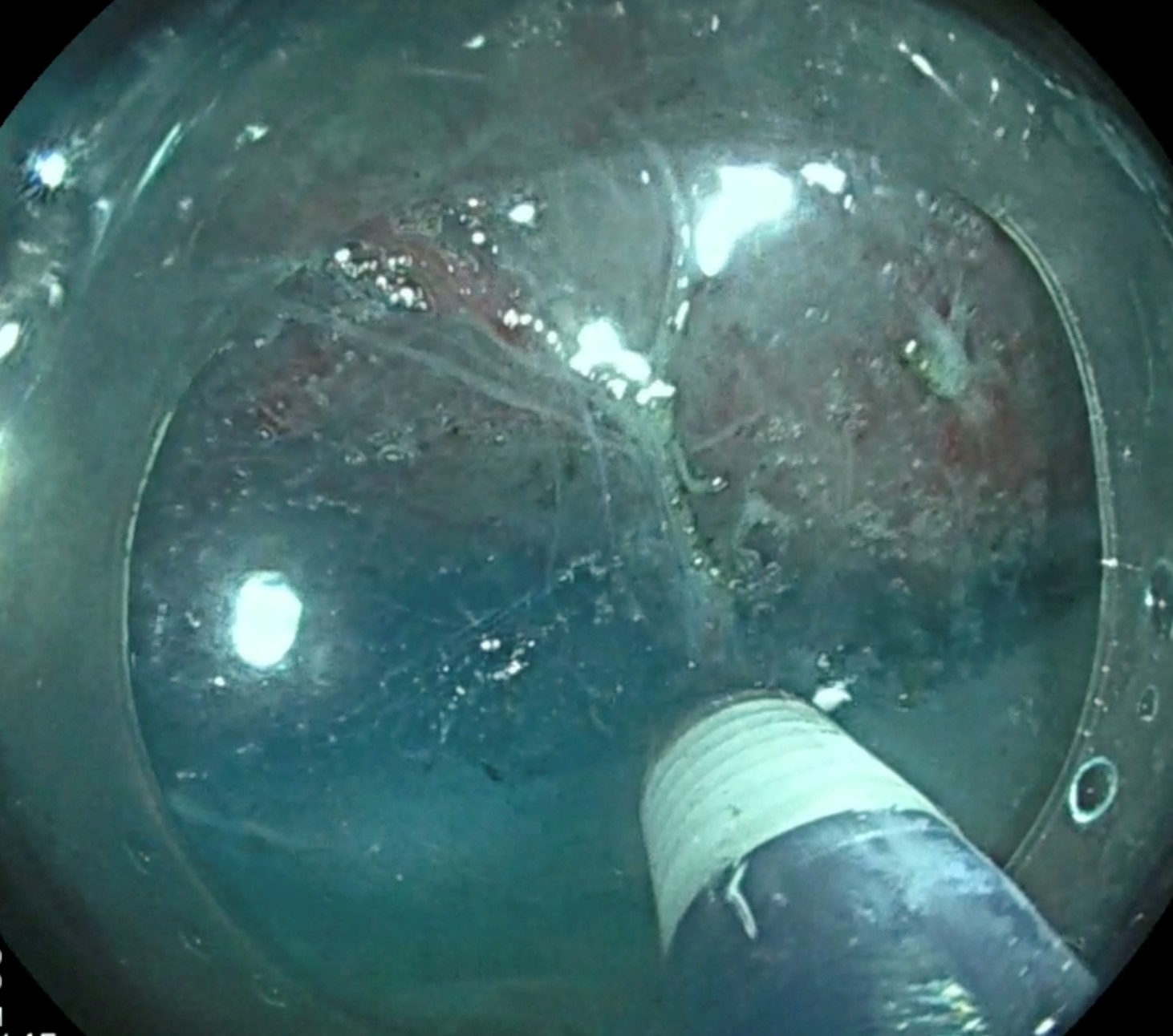 Détection et caractérisation par IA [crédit : DR BERTRAND BRIEAU]]