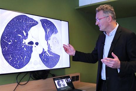 Le scanner face aux douleurs thoraciques