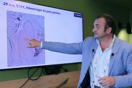 Une embolisation équitable en fil d'Ariane
