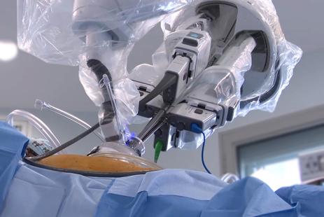 La chirurgie robot-assistée à incision unique