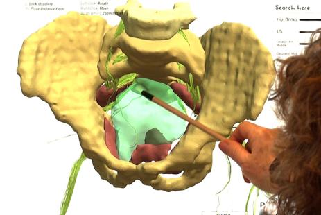 Des nerfs en 3D pour une chirurgie optimisée