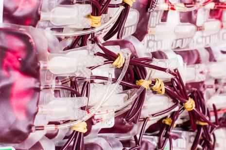 Congrès ASH 2024 : en hématologie, traiter plus tôt et plus fort
