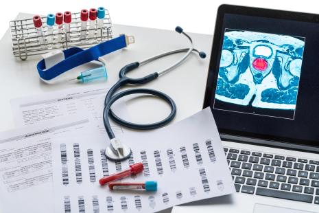 Les avantages du dépistage par dosage du PSA sont à mettre en regard du risque de surdiagnostic et de surtraitement