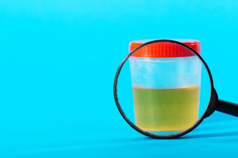 CFU 2025 : l’urologie questionne ses pratiques