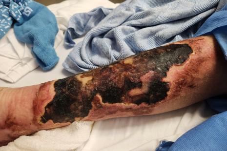 Les odeurspeuvent entraver le lien social