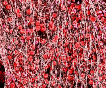 L'efficacité anti-thrombotique des deux posologies d'edoxaban est confirmée