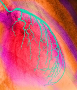 Réduire significativement les événements cardiovasculaires majeurs à 30 jours
