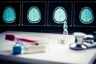 Illustration sur la télémédecine, ici cerveau normal en Imagerie par résonance magnétique (IRM)