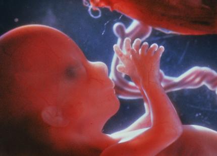 foetus