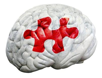 Alzheimer