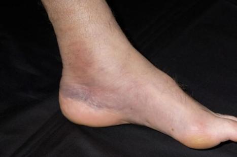 Pied