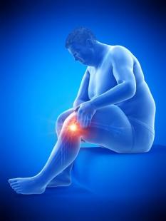 Arthrose et obésité