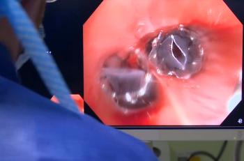 Emphysème : une valve dans l'air du temps
