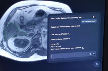 Bientôt un copilote IA pour le radiologue
