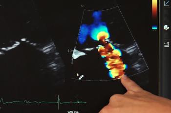 Insuffisance mitrale : l'échographie en ligne de fuite