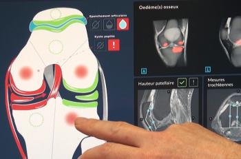 Plus jamais seul devant l'IRM du genou