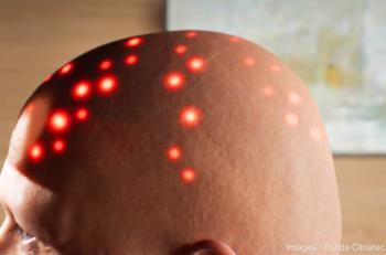 L'illumination proche infrarouge à l'essai dans le cerveau