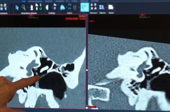 Surdité : le scanner met le pied à l'étrier
