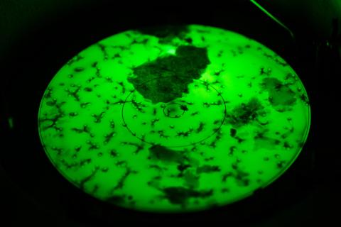 Congrès ERS 2025 : aux confins du poumon