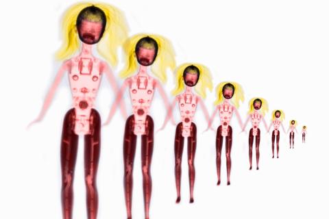 JFR 2025 : une imagerie tournée vers l’individualité des patients