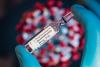 Covid-19 : pourquoi la dexaméthasone marche dans les formes sévères ?