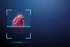 IRM cardiaque : un diagnostic augmenté déjà en routine