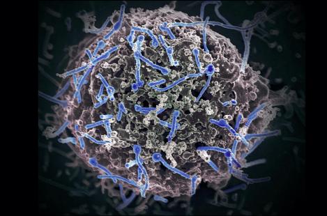 ebola