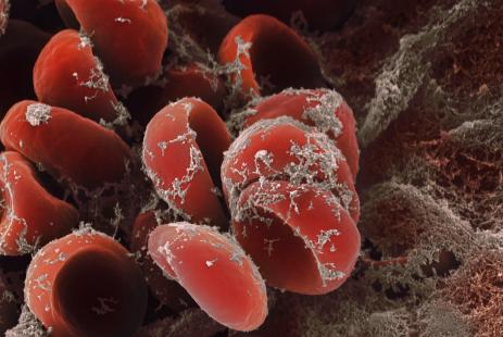 globules rouges