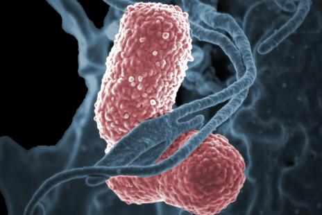 Klebsiella pneumoniae