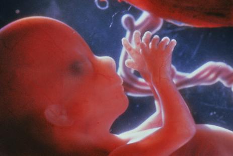 foetus