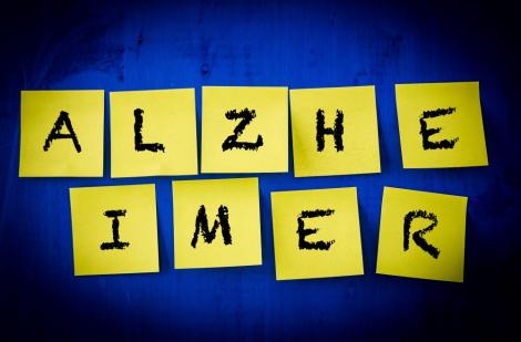 alzheimer