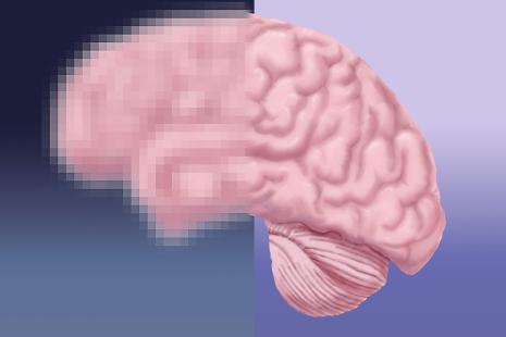 cerveau