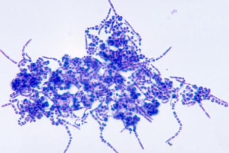 La dermatophilose est une dermatite habituellement contractée par des animaux (ovins, bovins et surtout chevaux) et causée par la bactérie 