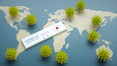 Entre autres recommandations, la FIP souhaite que les gouvernements s’appuient sur le maillage pharmaceutique pour la réalisation des tests rapides du Covid-19
