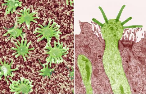 Certains virus infectent les neurones olfactifs et peuvent pénétrer dans le cerveau