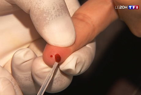 Images à la clé, certains officinaux ont déjà commencé à pratiquer les tests Covid dans leur officine (JT de TF1 25 mai 2020)