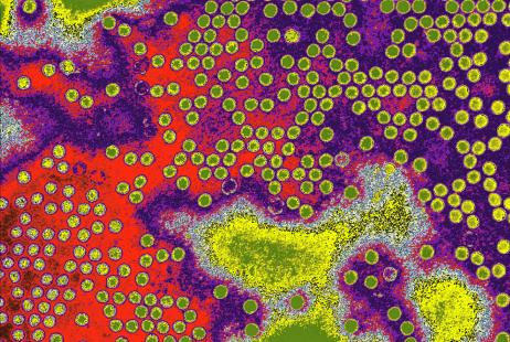 Ce 25 août, le continent africain a été déclaré « exempt de poliovirus sauvage »