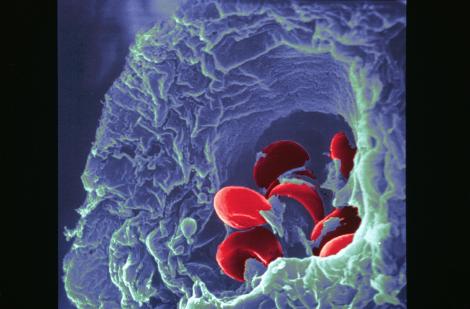 Le placenta conserverait une mémoire épigénétique de l'exposition au tabac