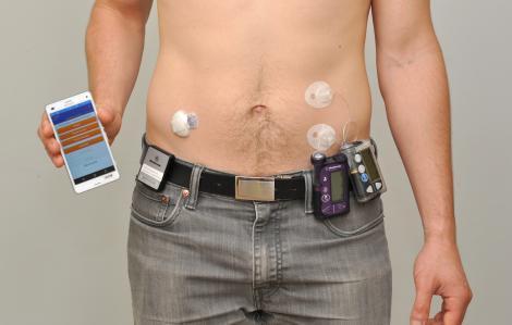 Une population cible de 3 500 patients