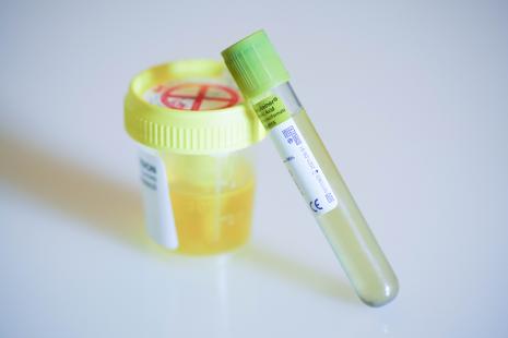 Ces résultats offrent une alternative crédible à l'antibiothérapie quotidienne