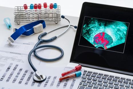 Il convient de distinguer aussi tôt que possible les tumeurs prostatiques qui progresseront rapidement de celles qui restent plus indolentes